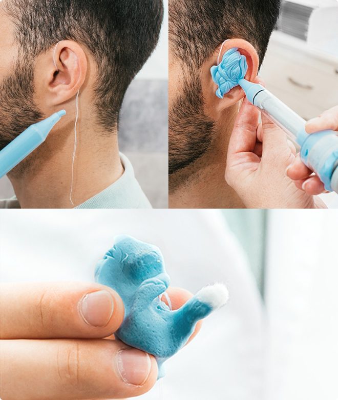 The process of making custom in-ear hearing plugs to help with hearing loss damage. 